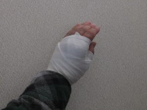 見た目すんごく痛々しい・・・