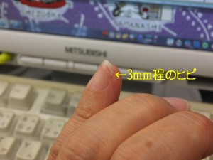 たんぱく質が足りない？